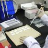 Kök hücre tedavisiyle AIDS tedavi edildi Kök hücre tedavisiyle AIDS tedavi edildi