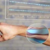 Google kanser teşhisi koyan bileklik üretti
