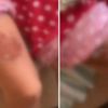 Sancaktepe'de kadına kocası tarafından ısıtılmış bıçak ile işkence iddiası