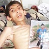Madaya'ya Şeytani Kuşatma! Madaya'ya Şeytani Kuşatma!