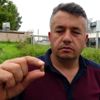 Burak, kaşına isabet eden maganda kurşunuyla yaralandı ...