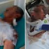 'İmam kulağımı ısırarak koparttı'