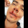 Öğretmen, üniversiteliyi beyzbol sopasıyla dövdü Öğretmen, üniversiteliyi beyzbol sopasıyla dövdü