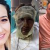 'Kızgın yağla yüzümü yaktı!' demişti, duruşmada inkar etti 'Kızgın yağla yüzümü yaktı!' demişti, duruşmada inkar etti