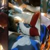 Otomobilde sıkıştı, "Lütfen kesmeyin bacağımı "diye ağladı Otomobilde sıkıştı, "Lütfen kesmeyin bacağımı "diye ağladı
