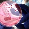 Meme kanseri hastalarına 'genetik test' önerisi Meme kanseri hastalarına 'genetik test' önerisi