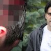 Ünlü futbolcu yenilgiyi hazmedemeyince üniversitelileri hastanelik etti