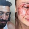 Çeşme'de darp edilen Ukraynalı model Daria Kyryliuk ifade verdi