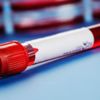 Hct (hematokrit) testi hakkında merak edilenler Hct (hematokrit) testi hakkında merak edilenler