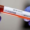 Başkale Devlet Hastanesi'nde 10 sağlık çalışanının koronavirüs testi pozitif çıktı