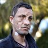 Türkiye nin ilk yüz nakillisi Uğur Acar: Tek isteğim ...