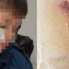 Esenler'de illkokulda öğrenciye darp iddiası:Yaramazlık yaptı vurdum Esenler'de illkokulda öğrenciye darp iddiası:Yaramazlık yaptı vurdum