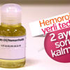 Hemoroid karışımı 2 günde ağrıyı kesip, 2 ayda bitiriyor