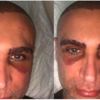 Doğuş'un son hali görenleri şaşırttı Doğuş'un son hali görenleri şaşırttı