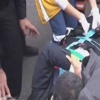 AK Partili vekil kazada yaralandı AK Partili vekil kazada yaralandı