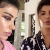 'Gözüne yumruk yedi' iddiasına yanıt 'Gözüne yumruk yedi' iddiasına yanıt