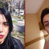 Estetik ameliyatı oldu, psikolojisi bozuldu Estetik ameliyatı oldu, psikolojisi bozuldu