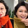 Nurgül Yeşilçay botoksuyla şoke etti