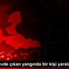 İzmir de evde çıkan yangında bir kişi yaralandı İzmir de evde çıkan yangında bir kişi yaralandı