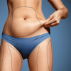 Lazer lipoliz ve liposuction arasındaki fark nedir?