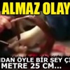 Karnından öyle birşey çıktı ki!