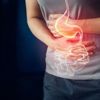 Crohn hastalığı nedir? Crohn hastalığı belirtileri nelerdir? Crohn hastalığı nedir? Crohn hastalığı belirtileri nelerdir?