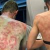 Fransa'da doluya yakalanan bisikletçiler bu hale geldi Fransa'da doluya yakalanan bisikletçiler bu hale geldi