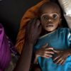 UNICEF: Burkina Faso'da yarım milyondan fazla çocuk yetersiz besleniyor UNICEF: Burkina Faso'da yarım milyondan fazla çocuk yetersiz besleniyor