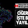Son dakika: Koronavirüs akciğerlere işte böyle yayılıyor Son dakika: Koronavirüs akciğerlere işte böyle yayılıyor