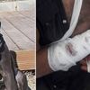 Pitbull sahibine saldırdı, polis vurarak kurtardı