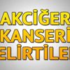 Akciğer kanseri nedir? Akciğer kanseri belirtileri ...