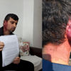 7 yıldır hastalığına çare arıyor