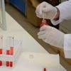 Hastalarına HIV bulaştırdığı iddiasıyla gözaltında