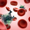 Türkiye’de AIDS alarmı Türkiye’de AIDS alarmı