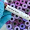 Koronavirüs bir ülkeye daha sıçradı!