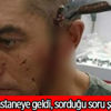 Başına saplanmış bıçakla hastaneye geldi!