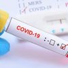 Rusya’da Covid-19 vakalarında rekor artış