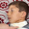İlkokulda çocukların kavgası kanlı bitti İlkokulda çocukların kavgası kanlı bitti