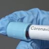 Azerbaycan’da koronavirüs vaka sayısı 3’e yükseldi
