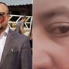 Yanağı koparılan avukat isyan etti!