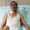 Doku nakli ile bacağı kesilmekten kurtuldu Doku nakli ile bacağı kesilmekten kurtuldu
