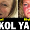 Alkol içen kadının vücudu yandı! Alkol içen kadının vücudu yandı!