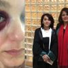 ‘Senin havan kime’ yumruğuna 1 yıl 6 ay hapis