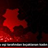 Boşandığı eşi tarafından bıçaklanan kadın yaralandı Boşandığı eşi tarafından bıçaklanan kadın yaralandı