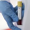 ABD'de koronavirüs kaynaklı can kaybı 85'e yükseldi