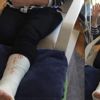 CHP’li Böke’den kongreye alçılı fotoğrafla mesaj CHP’li Böke’den kongreye alçılı fotoğrafla mesaj