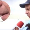 Kosta Rika Cumhurbaşkanı sinek yuttu