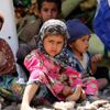 Yemen'deki çatışmalar sonucunda 28 bin aile yerinden oldu Yemen'deki çatışmalar sonucunda 28 bin aile yerinden oldu