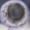 Zika virüsü beyin kanserinin tedavisinde kullanılabilir