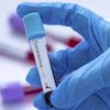 Covid-19'un mutasyonlarını tespit eden test sistemi geliştirildi